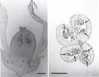 Fleur de C. edulis de type II : coupe longitudinale de l'ovaire (à gauche) et coupe transversale d'une anthère.